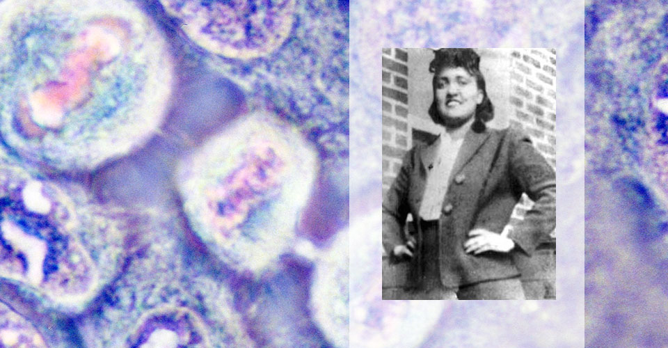 Henrietta Lacks and Her Vaccine Legacy