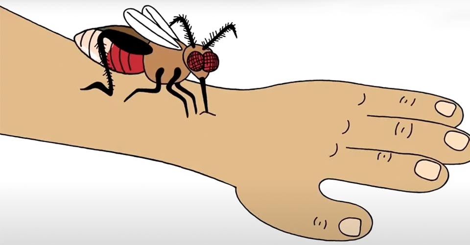 The Sting of Microaggressions